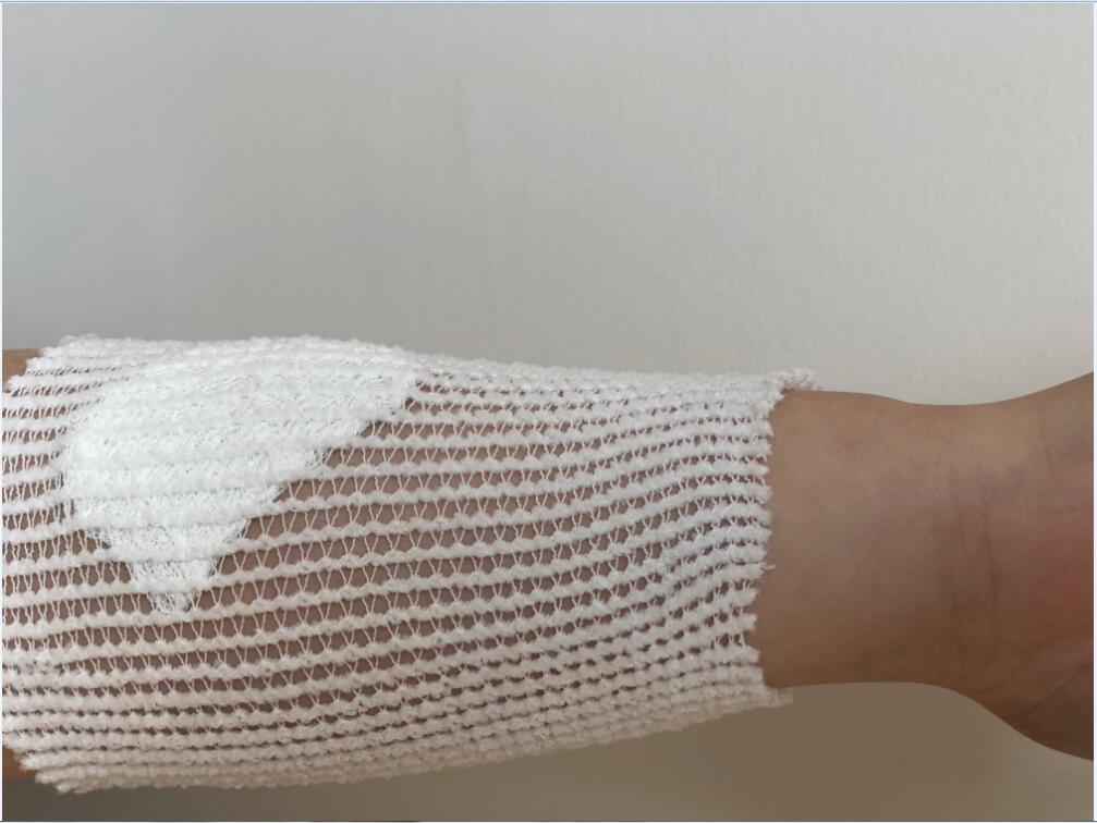 How a Tubular Net Bandage Can Help You During an Emergency